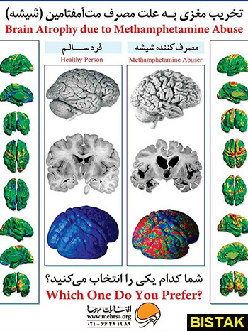 پوستر تخریب مغزی مهرسا